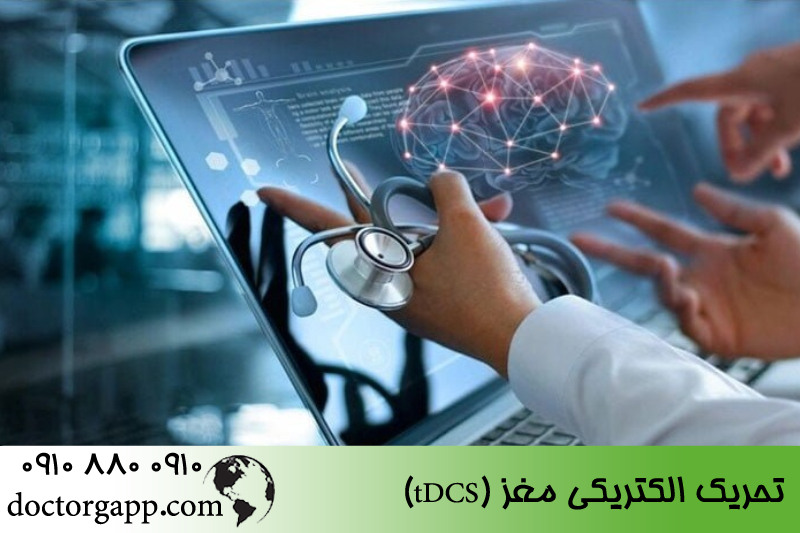 تحریک الکتریکی مغز (tDCS)