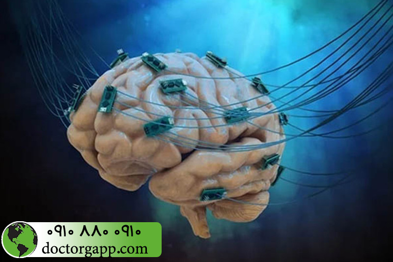 بررسی اثرات جانبی تحریک الکتریکی مغز 