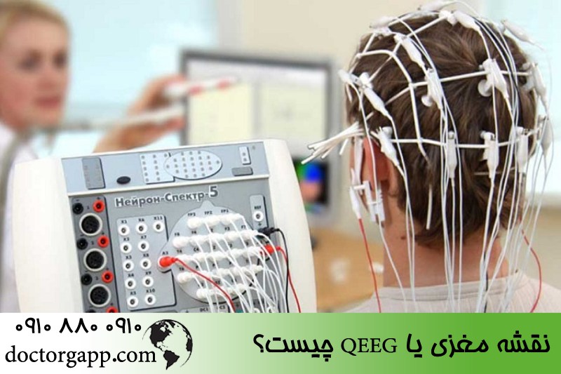 نقشه مغزی 